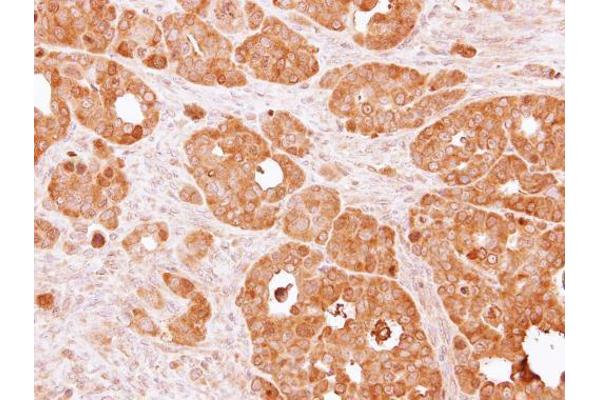 PSAT1 antibody