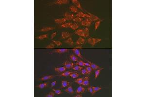 Immunofluorescence (IF) image for anti-Sorbitol Dehydrogenase (SORD) (AA 1-357) antibody (ABIN3022962)