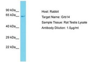 Image no. 1 for anti-Growth Factor Receptor-Bound Protein 14 (GRB14) (AA 251-300) antibody (ABIN6750502) (GRB14 antibody  (AA 251-300))