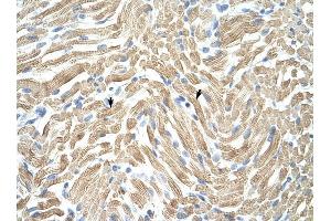Tropomyosin 1 antibody was used for immunohistochemistry at a concentration of 4-8 ug/ml to stain Skeletal muscle cells (arrows) in Human Muscle. (Tropomyosin antibody)