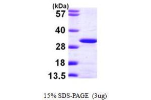 SDS-PAGE (SDS) image for Ubiquitin-Conjugating Enzyme E2K (UBE2K) (AA 1-200) protein (His tag) (ABIN7279311) (UBE2K Protein (AA 1-200) (His tag))