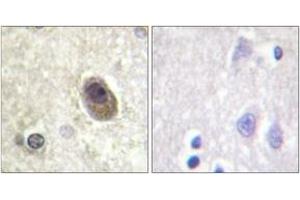 Immunohistochemistry analysis of paraffin-embedded human brain, using BAD (Phospho-Ser134) Antibody. (BAD antibody  (pSer134))