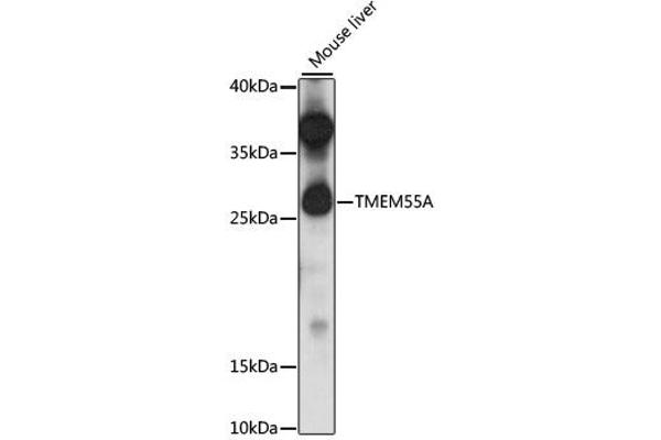 TMEM55A 抗体