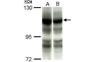 WB Image Sample (50 ug of whole cell lysate) A: C2C12 B: C2C12+AEA10mM antibody diluted at 1:1000 (PIK3CA antibody  (N-Term))