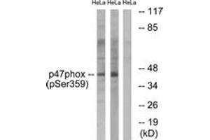 Western blot analysis of extracts from HeLa cells treated with nocodazole 1ug/ml 18h, using p47 phox (Phospho-Ser359) Antibody. (NCF1 antibody  (pSer359))