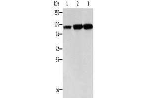 Western Blotting (WB) image for anti-Heat Shock 105kDa/110kDa Protein 1 (HSPH1) antibody (ABIN2421692) (HSPH1 antibody)