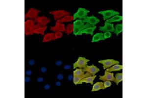 anti-Seizure Related 6 Homolog (SEZ6) antibody