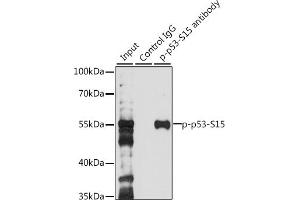 Immunoprecipitation analysis of 200 μg extracts of 293T cells, using 3 μg Phospho-p53-S15 pAb (ABIN3023600, ABIN3023601, ABIN3023602 and ABIN6225458). (p53 antibody  (pSer15))
