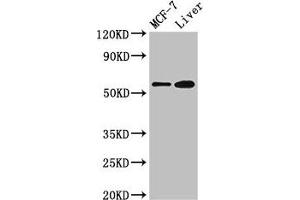 Western Blot Positive WB detected in: MCF-7 whole cell lysate, Mouse liver tissue All lanes: CBS antibody at 2. (CBS antibody  (AA 1-413))