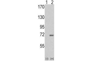 Western blot analysis of IRAK antibody and 293 cell lysate either nontransfected (Lane 1) or transiently transfected with the IRAK1 gene (2).