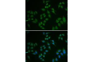 Immunofluorescence analysis of U2OS cells using TP63 antibody (ABIN5971164). (p63 antibody)