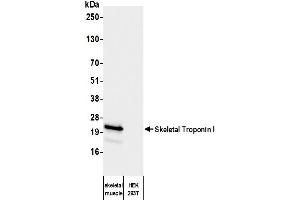 Western Blotting (WB) image for anti-Troponin I (TNNI) antibody (ABIN7795609)