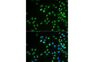 Immunofluorescence analysis of HeLa cell using DDX41 antibody. (DDX41 antibody)