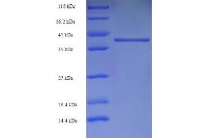 GABRA4 Protein (AA 36-258) (His-SUMO Tag)
