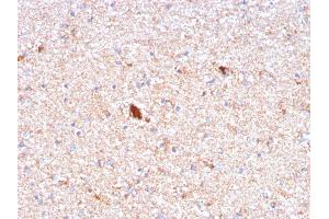 Formalin-fixed, paraffin-embedded human Brain stained with Serum Amyloid P Mouse Monoclonal Antibody (APCS/3240).