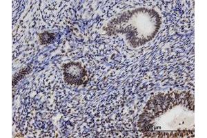 anti-Zinc Finger, C3H1-Type Containing (ZFC3H1) (AA 1-359) antibody