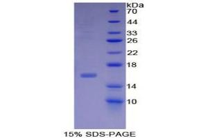 SDS-PAGE (SDS) image for Inhibin, beta B (INHBB) (AA 293-407) protein (His tag) (ABIN1079929) (INHBB Protein (AA 293-407) (His tag))