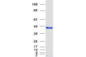 Western Blotting (WB) image for Sjogren Syndrome Antigen B (SSB) protein (Myc-DYKDDDDK Tag) (ABIN2732688)