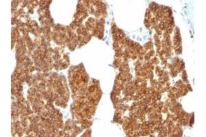 Formalin-fixed, paraffin-embedded human Parathyroid Gland stained with PTH Rabbit Polyclonal Antibody. (PTH antibody  (AA 1-115))
