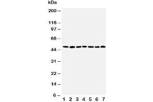 Western blot testing of CtBP1 antibody and Lane 1:  rat brain (CTBP1 antibody  (AA 425-440))