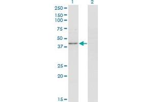 Western Blot analysis of PPP1R8 expression in transfected 293T cell line by PPP1R8 monoclonal antibody (M05), clone 4B5. (PPP1R8 antibody  (AA 28-127))