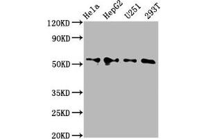 Western Blot Positive WB detected in: Hela whole cell lysate, HepG2 whole cell lysate, U251 whole cell lysate, 293T whole cell lysate All lanes: CCT6A antibody at 4. (CCT6A antibody  (AA 80-250))