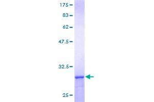 CCT8 Protein (AA 1-27) (GST tag)