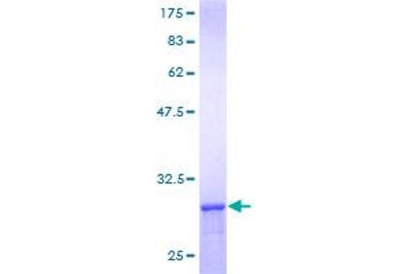 CCT8 Protein (AA 1-27) (GST tag)