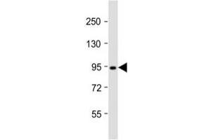Western Blotting (WB) image for anti-DNA (Cytosine-5-)-Methyltransferase 3 beta (DNMT3B) (AA 389-417) antibody (ABIN3030752)
