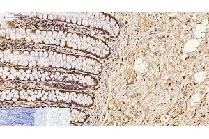 Immunohistochemistry of paraffin-embedded Human colon tissue using CDX2 Monoclonal Antibody at dilution of 1:200. (CDX2 antibody)
