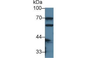 Western blot analysis of Mouse Small intestine lysate, using Mouse CES1 Antibody (2 µg/ml) and HRP-conjugated Goat Anti-Rabbit antibody ( (CES1 antibody  (AA 31-286))