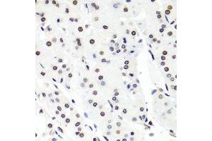 Immunohistochemistry of paraffin-embedded human stomach using HIST1H2BG antibody (ABIN6003628) at dilution of 1/100 (40x lens). (HIST1H2BG antibody)