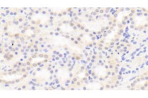 Immunohistochemistry (IHC) image for anti-Coagulation Factor II (thrombin) (F2) (AA 44-200) antibody (ABIN7429277)