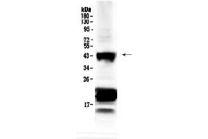 Western blot analysis of CHX10 using anti-CHX10 antibody .