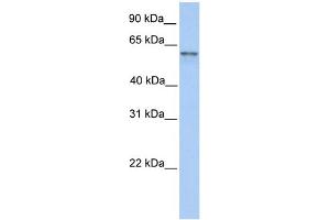 WB Suggested Anti-FAM13C1 Antibody Titration: 0. (FAM13C antibody  (N-Term))