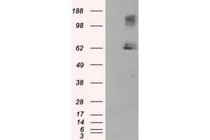HEK293T cells were transfected with the pCMV6-ENTRY control (Left lane) or pCMV6-ENTRY LIPG (Right lane) cDNA for 48 hrs and lysed. (LIPG antibody)