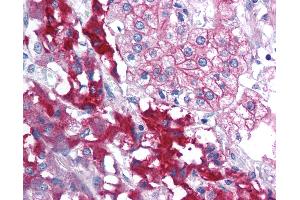 Anti-RPAIN antibody IHC of human adrenal. (RPAIN antibody  (C-Term))