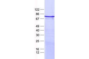 ZNF449 Protein (His tag)