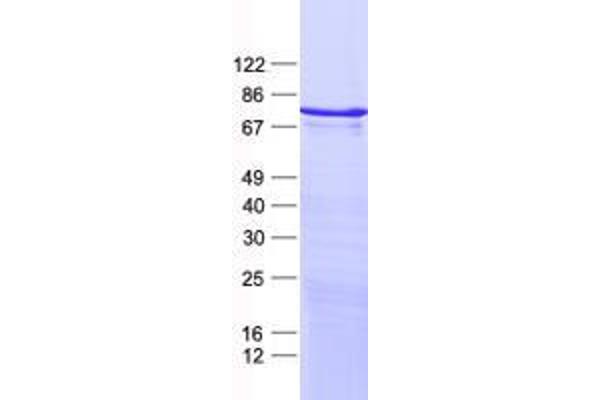 ZNF449 Protein (His tag)