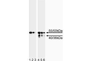 Western blot analysis of caspase-8. (Caspase 8 antibody)