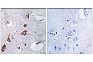 Immunohistochemistry analysis of paraffin-embedded human brain tissue, using CHSY1 antibody. (CHSY1 antibody  (Internal Region))
