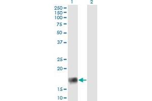 Western Blot analysis of XAGE2 expression in transfected 293T cell line by XAGE2 monoclonal antibody (M12), clone 4C4. (XAGE2 antibody  (AA 44-111))