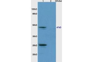Lane 1: mouse brain lysates Lane 2: mouse embryo lysates probed with Anti phospho-Smad3 (Ser213) Polyclonal Antibody, Unconjugated (ABIN802383) at 1:200 in 4 °C. (SMAD3 antibody  (pSer213))