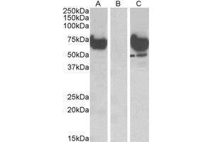 HEK293 lysate (10 µg protein in RIPA buffer) overexpressing Human EPM2AIP1 with DYKDDDDK tag probed with EPM2AIP1 Antibody (1 µg/ml) in Lane A and probed with anti-DYKDDDDK Tag (1/1000) in lane C. (EPM2AIP1 antibody  (Internal Region))