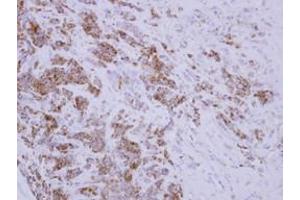 Image no. 1 for anti-DnaJ (Hsp40) Homolog, Subfamily A, Member 3 (DNAJA3) (AA 1-446) antibody (ABIN1497866) (DNAJA3 antibody  (AA 1-446))