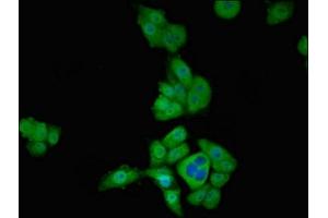 Immunofluorescent analysis of PC-3 cells using ABIN7171293 at dilution of 1:100 and Alexa Fluor 488-congugated AffiniPure Goat Anti-Rabbit IgG(H+L) (T-Box 1 antibody  (AA 22-107))