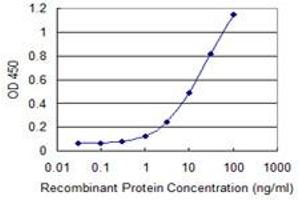 Detection limit for recombinant GST tagged PGM1 is 0. (Phosphoglucomutase 1 antibody  (AA 1-562))