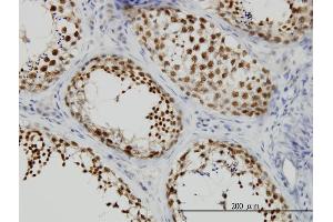 Immunoperoxidase of monoclonal antibody to KIF2 on formalin-fixed paraffin-embedded human testis.