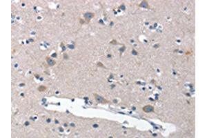 The image on the left is immunohistochemistry of paraffin-embedded Human brain tissue using ABIN7189813(ANP32C Antibody) at dilution 1/30, on the right is treated with synthetic peptide. (ANP32C antibody)