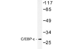 Image no. 1 for anti-CCAAT/enhancer Binding Protein (C/EBP), epsilon (CEBPE) antibody (ABIN272198) (CEBPE antibody)